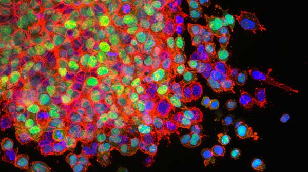 New clue discovered for how and why cancer cells spread